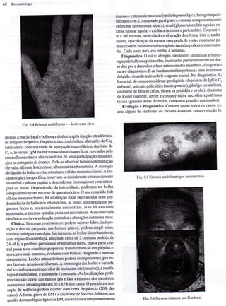 Dermatologia   doenças basicamente eritematosas
