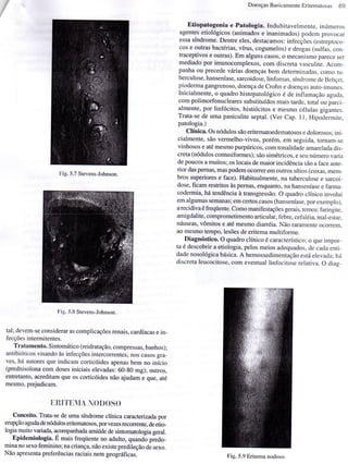 Dermatologia   doenças basicamente eritematosas