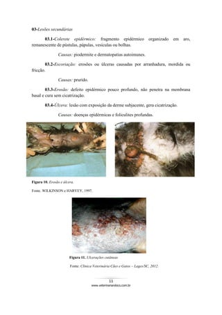 11
www.veterinariandocs.com.br
03-Lesões secundárias
03.1-Colerete epidérmico: fragmento epidérmico organizado em aro,
remanescente de pústulas, pápulas, vesículas ou bolhas.
Causas: piodermite e dermatopatias autoimunes.
03.2-Escoriação: erosões ou úlceras causadas por arranhadura, mordida ou
fricção.
Causas: prurido.
03.3-Erosão: defeito epidérmico pouco profundo, não penetra na membrana
basal e cura sem cicatrização.
03.4-Úlcera: lesão com exposição da derme subjacente, gera cicatrização.
Causas: doenças epidérmicas e foliculites profundas.
Figura 10. Erosão e úlcera.
Fonte. WILKINSON e HARVEY, 1997.
Figura 11. Ulcerações cutâneas
Fonte: Clínica Veterinária Cães e Gatos – Lages/SC, 2012.
 