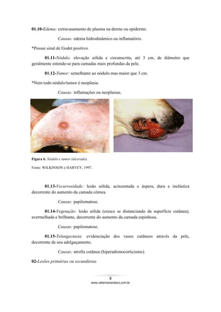 8
www.veterinariandocs.com.br
01.10-Edema: extravasamento de plasma na derme ou epiderme.
Causas: edema hidrodinâmico ou inflamatório.
*Possui sinal de Godet positivo.
01.11-Nódulo: elevação sólida e circunscrita, até 3 cm, de diâmetro que
geralmente estende-se para camadas mais profundas da pele.
01.12-Tumor: semelhante ao nódulo mas maior que 3 cm.
*Nem todo nódulo/tumor é neoplasia.
Causas: inflamações ou neoplasias.
Figura 6. Nódulo e tumor (ulcerado).
Fonte: WILKINSON e HARVEY, 1997.
01.13-Vecurrosidade: lesão sólida, acinzentada e áspera, dura e inelástica
decorrente do aumento da camada córnea.
Causas: papilomatose.
01.14-Vegetação: lesão sólida (cresce se distanciando da superfície cutânea),
avermelhada e brilhante, decorrente do aumento da camada espinhosa.
Causas: papilomatose.
01.15-Telangectasia: evidenciação dos vasos cutâneos através da pele,
decorrente de seu adelgaçamento.
Causas: atrofia cutânea (hiperadrenocorticismo).
02-Lesões primárias ou secundárias
 
