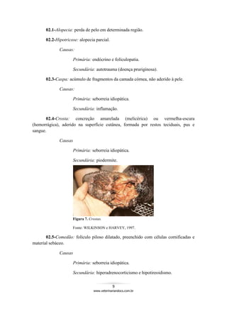 9
www.veterinariandocs.com.br
02.1-Alopecia: perda de pelo em determinada região.
02.2-Hipotricose: alopecia parcial.
Causas:
Primária: endócrino e folículopatia.
Secundária: autotrauma (doença pruriginosa).
02.3-Caspa: acúmulo de fragmentos da camada córnea, não aderido à pele.
Causas:
Primária: seborreia idiopática.
Secundária: inflamação.
02.4-Crosta: concreção amarelada (melicérica) ou vermelha-escura
(hemorrágica), aderido na superfície cutânea, formada por restos teciduais, pus e
sangue.
Causas
Primária: seborreia idiopática.
Secundária: piodermite.
Figura 7. Crostas.
Fonte: WILKINSON e HARVEY, 1997.
02.5-Comedão: folículo piloso dilatado, preenchido com células cornificadas e
material sebáceo.
Causas
Primária: seborreia idiopática.
Secundária: hiperadrenocorticismo e hipotireoidismo.
 