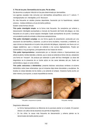 5. Tiña de los pies. Dermatoficia de los pies. Pie de atleta.
Se denomina a cualquier infección en los pies determinada por dermatofitos.
Los agentes causales más comunes son dermatofitos antropofílicos como el T. rubrum, T.
mentagrophytes var. interdigitale y el E. floccosum.
Es más frecuente en adultos jóvenes deportistas, favorecido por la hiperhidrosis, calzado
oclusivo, medias sintéticas y el uso de baños públicos.
Existen varias formas clínicas:
Tiña pedis interdigital simple: es la forma más frecuente. Se caracteriza por eritema y
descamación interdigital acompañada a menudo de fisuración del fondo del pliegue, es más
frecuente en el cuarto y tercer espacio interdigital. Suele acompañarse de prurito. Constituye
una excelente puerta de entrada a infecciones estreptocócicas.
Tiña pedis interdigital compleja: es una forma aguda de presentación, producida por una
asociación de dermatofitos y bacterias. La piel se torna exudativa, macerada y maloliente. La
capa córnea se desprende en la parte más profunda del pliegue, originando una fisura con un
colgajo epidérmico, que a menudo se extiende a los surcos digitoplantares. Puede ser
asintomático o muy pruriginoso, principalmente en los meses de verano.
Tiña pedis hiperqueratósica: caracterizada por un discreto eritema e hiperqueratosis que
afecta la planta, bordes laterales y talones, que a veces se extiende al dorso del pie, adoptando
una forma en “mocasín”. Se produce por extensión a partir del foco interdigital. La clave del
diagnóstico es la presencia de un borde activo en las caras laterales del pie. Suele ser
asintomática y sigue un curso crónico.
Tiña pedis vesiculosa o dishidrótica: presenta lesiones vesiculosas similares al eccema
dishidrótico sobre base eritematosa, que al romperse deja áreas denudadas y exudativas. Se
localiza en áreas laterales de los dedos y se extiende al antepie. Ocasiona fuerte prurito y/o
dolor intenso y la erupción, a veces imposibilita la marcha.
Tiña pedis: compromiso en plantas Tiña pedis: intertrigo
Diagnóstico diferencial:
­ La forma hiperqueratósica se diferencia de la psoriasis plantar en el adulto. El examen
directo o el cultivo de las escamas nos permite el diagnóstico.
­ En los niños, la causa más frecuente de descamación y eritema plantar es la
denominada dermatitis plantar juvenil.
102
 