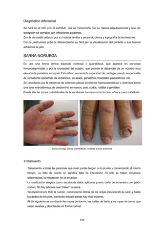 Diagnóstico diferencial
Se hará en el niño con el estrófulo, que es monomorfo con su clásica papulovesícula y que por
excepción se complica con infecciones piógenas.
Con la dermatitis atópica: por su historia familiar y personal, clínica y topografía de las lesiones.
Con la pediculosis pubis la diferenciación es fácil por la visualización del parásito y sus huevos
adheridos al pelo.
SARNA NORUEGA
Es una una forma clínica especial, costrosa o queratósica, que aparece en personas
inmunodeprimidas o por la cronicidad del cuadro, que permite el desarrollo de un número muy
elevado de parásitos en la piel. Esto último aumenta la capacidad de contagio, siendo responsable
de verdaderas epidemias de escabiosis, en asilos, geriátricos, hospitales psiquiátricos, etc.
Se caracteriza por la presencia de extensas placas simétricas hiperqueratósicas y costrosas sobre
una base eritrodérmica, de predominio en manos, pies, codos, rodillas y genitales.
Puede afectar zonas no habituales de la escabiosis humana como la cara, uñas y cuero cabelludo.
Sarna noruega: placas queratósicas, múltiples surcos acarianos
Tratamiento
Tratamiento a todas las personas que viven juntas tengan o no prurito y comenzando al mismo
tiempo. La falta de prurito no significa falta de infestación. Si sólo se tratan individuos
sintomáticos, la infestación no se erradica.
La medicación elegida como escabicida debe aplicarse previo baño de inmersión con jabón
común. No hay jabones que “traten” la sarna.
Se esparcirá por todo el cuerpo, comenzando detrás de las orejas (respetando la cara) y hasta
los dedos de los pies, poniendo énfasis donde hay más lesiones.
Al día siguiente se cambiarán las ropas de dormir, las toallas de baño y las ropas de cama, que
serán lavadas y planchadas en forma normal.
126
 
