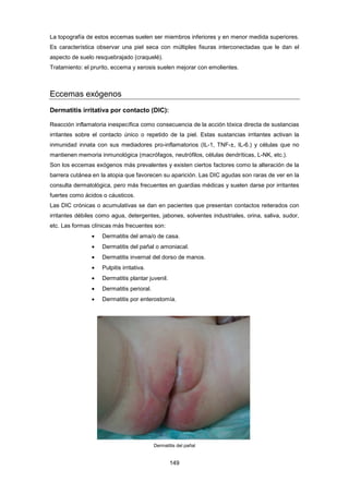 La topografía de estos eccemas suelen ser miembros inferiores y en menor medida superiores.
Es característica observar una piel seca con múltiples fisuras interconectadas que le dan el
aspecto de suelo resquebrajado (craquelé).
Tratamiento: el prurito, eccema y xerosis suelen mejorar con emolientes.
Eccemas exógenos
Dermatitis irritativa por contacto (DIC):
Reacción inflamatoria inespecífica como consecuencia de la acción tóxica directa de sustancias
irritantes sobre el contacto único o repetido de la piel. Estas sustancias irritantes activan la
inmunidad innata con sus mediadores pro-inflamatorios (IL-1, TNF-±, IL-6.) y células que no
mantienen memoria inmunológica (macrófagos, neutrófilos, células dendríticas, L-NK, etc.).
Son los eccemas exógenos más prevalentes y existen ciertos factores como la alteración de la
barrera cutánea en la atopia que favorecen su aparición. Las DIC agudas son raras de ver en la
consulta dermatológica, pero más frecuentes en guardias médicas y suelen darse por irritantes
fuertes como ácidos o cáusticos.
Las DIC crónicas o acumulativas se dan en pacientes que presentan contactos reiterados con
irritantes débiles como agua, detergentes, jabones, solventes industriales, orina, saliva, sudor,
etc. Las formas clínicas más frecuentes son:
• Dermatitis del ama/o de casa.
• Dermatitis del pañal o amoniacal.
• Dermatitis invernal del dorso de manos.
• Pulpitis irritativa.
• Dermatitis plantar juvenil.
• Dermatitis perioral.
• Dermatitis por enterostomía.
Dermatitis del pañal
149
 