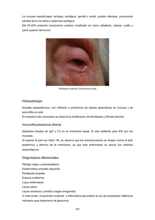 La mucosa nasofaríngea, laríngea, esofágica, genital y rectal, pueden afectase, provocando
pérdida de la vía aérea y estenosis esofágica.
Del 25-35% presenta compromiso cutáneo, localizado en cuero cabelludo, cabeza, cuello y
parte superior del tronco.
Penfigoide cicatrizal. Compromiso ocular
Histopatología
Ampolla subepidérmica, con infiltrado a predominio de células plasmáticas en mucosa y de
eosinófilos en piel.
En estadios más avanzados se observa la proliferación de fibroblastos y fibrosis laminar.
Inmunofluorescencia directa
Depósitos lineales de IgG y C3 en la membrana basal. El sitio preferido para IFD son las
mucosas.
Al separar la piel con NaCl 1M, se observa que los autoanticuerpos se dirigen contra el lado
epidérmico y dérmico de la membrana, ya que esta enfermedad se asocia con distintos
autoantígenos.
Diagnósticos diferenciales
Pénfigo vulgar y paraneoplásico
Epidermólisis ampollar adquirida
Penfigoide ampollar
Eritema multiforme
Lupus eritematoso
Liquen plano
Liquen escleroso y atrófico (región anogenital)
A nivel ocular: conjuntivitis cicatrizal o inflamatoria secundaria al uso de preparados oftálmicos
indicados para tratamiento de glaucoma.
161
 