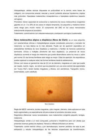 Histopatología: células névicas dispuestas en profundidad en la dermis, entre haces de
colágeno, con compromiso anexial, vascular y neural, pudiendo alcanzar hipodermis y tejidos
más profundos. Hiperplasia melanocítica intraepidérmica e hiperplasia epidérmica (aspecto
verrugoso).
Pronóstico: tienen capacidad de evolucionar a melanoma los nevos melanocíticos congénitos
gigantes en un 5 a 20% de los casos en etapas tempranas, los pequeños y medianos tienen
cierto riesgo pero mucho menor. El compromiso del SNC en los casos mencionados
anteriormente empeora el pronóstico.
Tratamiento: control estricto con videodermatoscopía y extirpación quirúrgica (cuestionada).
Nevo melanocítico atípico o displásico (Nevo de Clark): es un nevo adquirido
con características clínicas e histopatológicas propias considerado precursor y marcador de
melanoma. La raza blanca es la más afectada. Puede ser de aparición esporádica sin
antecedentes familiares de nevo displásico y melanoma, o familiar de herencia autosómica
dominante. Únicos o múltiples (Síndrome del nevo displásico). La presencia de nevos
displásicos aumenta el riesgo de melanoma que puede desarrollarse sobre los nevos o sobre
piel normal. En las formas familiares este riesgo es mayor. Edad de aparición: los esporádicos
pueden aparecer a cualquier edad, las formas familiares desde la adolescencia.
Clínica: son nevos en general de más de 0,5 cm de diámetro, irregulares en color que puede
ser rosado, marrón, negro, es común que se presenten con una zona central más pigmentada
(en “huevo frito”), tienen bordes irregulares y difusos, son asimétricos. Topografía: tronco,
extremidades, cuero cabelludo.
Nevo displásico
Regla del ABCD: asimetría, bordes irregulares, color irregular, diámetro, debe aplicarse en toda
lesión pigmentada y es especialmente útil para evaluar el pronóstico de estos nevos.
Diagnóstico diferencial: nevos nevocelulares, nevo melanocítico congénito pequeño, lentigos,
melanoma.
Histopatología: similar a un nevo compuesto, juntcional o intradérmico pero con células que
presentan diversos grados de displasia. Fibrosis e infiltrado linfocitario en dermis.
Tratamiento: control estricto clínico y por dermatoscopía, examen periódico de toda la piel;
extirpación y estudio histopatológico de las lesiones sospechosas de transformación,
180
 