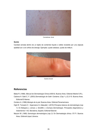 Comedones. Acné
Quiste
Cavidad cerrada dentro de un tejido de contenido líquido o sólido revestido por una cápsula
epitelial con o sin orificio de drenaje. Ejemplos: quiste sebáceo, quiste de millium.
Quiste sinovial
Referencias
Balsa R. (1998). Manual de Dermatología Clínica (405-6). Buenos Aires. Editorial Atlante S.R.L.
Cabrera H. Gatti C. F. (2003) Dermatología de Gatti- Cardama. (Cap 1 y 2) 2-15. Buenos Aires.
Editorial El Ateneo.
Cordero A. (1996) Biología de la piel. Buenos Aires. Editorial Panamericana.
High W. Tomasini C. Argenziano G. Zalaudek I. (2016) Principios básicos de dermatología (cap
1). En Bolognia J, Jorizzo J, Schaffer J. (Comps) Dermatología. Principales diagnósticos y
tratamientos 1-42. Barcelona, España. Editorial Elsevier.
Mazzini M. (1985) Semiología dermatológica (cap 3). En Dermatología clínica. 57-71. Buenos
Aires. Editorial López Libreros.
26
 