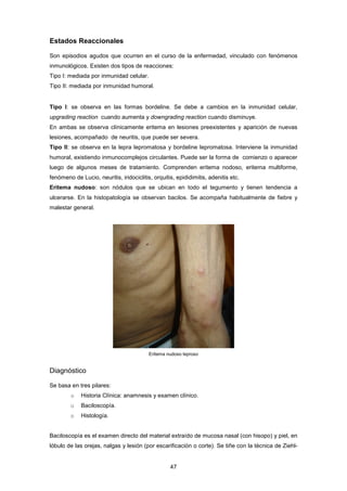 Estados Reaccionales
Son episodios agudos que ocurren en el curso de la enfermedad, vinculado con fenómenos
inmunológicos. Existen dos tipos de reacciones:
Tipo I: mediada por inmunidad celular.
Tipo II: mediada por inmunidad humoral.
Tipo I: se observa en las formas bordeline. Se debe a cambios en la inmunidad celular,
upgrading reaction cuando aumenta y downgrading reaction cuando disminuye.
En ambas se observa clínicamente eritema en lesiones preexistentes y aparición de nuevas
lesiones, acompañado de neuritis, que puede ser severa.
Tipo II: se observa en la lepra lepromatosa y bordeline lepromatosa. Interviene la inmunidad
humoral, existiendo inmunocomplejos circulantes. Puede ser la forma de comienzo o aparecer
luego de algunos meses de tratamiento. Comprenden eritema nodoso, eritema multiforme,
fenómeno de Lucio, neuritis, iridociclitis, orquitis, epididimitis, adenitis etc.
Eritema nudoso: son nódulos que se ubican en todo el tegumento y tienen tendencia a
ulcerarse. En la histopatología se observan bacilos. Se acompaña habitualmente de fiebre y
malestar general.
Eritema nudoso leproso
Diagnóstico
Se basa en tres pilares:
o Historia Clínica: anamnesis y examen clínico.
o Baciloscopía.
o Histología.
Baciloscopía es el examen directo del material extraído de mucosa nasal (con hisopo) y piel, en
lóbulo de las orejas, nalgas y lesión (por escarificación o corte). Se tiñe con la técnica de Ziehl-
47
 