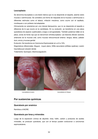 Leucoplasia
Se denomina leucoplasia a una lesión blanca que no se desprende al rasparla, asienta sobre
mucosa o semimucosa. Se considera una forma de respuesta de la mucosa o semimucosa a
diferentes estímulos como el tabaco, irritación mecánica, como ocurre con el cepillado,
mordisqueo o con prótesis mal adaptadas.
Clínicamente se caracteriza por una mácula blanquecina, que no se desprende al rasparla a
diferencia de lo que ocurre en la candidiasis. En su evolución, se transforma en una placa
queratósica de aspecto cuadriculado y luego a verrugosidades. También podemos hallar en la
placa, zonas de fondo rojo que se denominan eritroleucoplasia. Las lesiones afectan sectores
anteriores de la mucosa oral, como mucosa retrocomisural anterior, lengua, labios, paladar
duro, encía y mucosa genital.
Evolución: Se transforma en Carcinoma Espinocelular en un 6 a 10%.
Diagnósticos diferenciales: Muguet, Liquen plano, Sífilis secundaria (sifílides opalinas). Lesión
traumática por oclusión dental.
Tratamiento: Quirúrgico. Electrocoagulación.
Leucoplasia en pene Leucoplasia en lengua
Por sustancias químicas
Queratosis por arsénico
Remitirse a HACRE.
Queratosis por brea y minerales
Luego de la exposición crónica de alquitrán, brea, hollín, carbón y productos de aceites
minerales, se producen queratosis, que con el tiempo pueden evolucionar a carcinomas
espinocelulares.
53
 