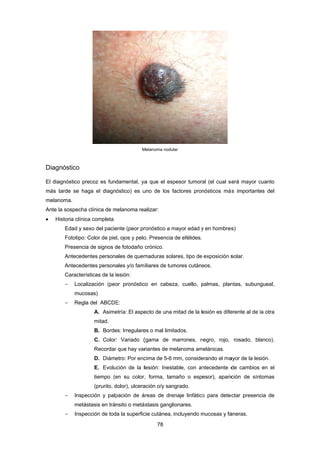 Diag
El dia
más
melan
Ante
 H
gnóstico
agnóstico pr
tarde se ha
noma.
la sospecha
Historia clínic
Edad y se
Fototipo:
Presencia
Antecede
Antecede
Caracterí
- Local
muco
- Regla
- Inspe
metás
- Inspe
recoz es fun
aga el diagn
a clínica de m
ca completa
exo del pacie
Color de pie
a de signos d
entes person
entes person
ísticas de la
lización (peo
osas)
a del ABCDE
A. Asime
mitad.
B. Borde
C. Color
Recordar
D. Diám
E. Evolu
tiempo (e
(prurito, d
ección y palp
stasis en trá
ección de tod
M
damental, ya
óstico) es u
melanoma rea
ente (peor pr
el, ojos y pelo
de fotodaño
ales de quem
ales y/o fam
lesión:
or pronóstic
E:
etría: El aspe
es: Irregulare
r: Variado (
r que hay var
etro: Por enc
ución de la l
en su color
dolor), ulcera
pación de á
nsito o metá
da la superfic
78 
Melanoma nodul
a que el esp
uno de los f
alizar:
ronóstico a m
o. Presencia
crónico.
maduras sola
iliares de tum
co en cabez
ecto de una
es o mal limit
(gama de m
riantes de m
cima de 5-6
lesión: Inest
, forma, tam
ación o/y san
áreas de dre
ástasis gangl
cie cutánea,
lar
pesor tumora
factores pron
mayor edad y
de efélides.
ares, tipo de
mores cutáne
za, cuello, p
mitad de la l
tados.
marrones, n
elanoma am
mm, conside
table, con an
maño o esp
ngrado.
enaje linfático
ionares.
incluyendo m
al (el cual se
nósticos má
y en hombres
exposición s
eos.
palmas, plan
esión es dife
negro, rojo,
melánicas.
erando el ma
ntecedente d
esor), aparic
o para detec
mucosas y fa
erá mayor c
ás importante
s)
solar.
ntas, subun
erente al de l
rosado, bla
ayor de la les
de cambios
ción de sínt
ctar presenc
aneras.
cuanto
es del
gueal,
la otra
anco).
sión.
en el
tomas
cia de
 