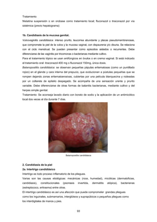 Tratamiento
Nistatina suspensión o en orobase como tratamiento local; fluconazol o itraconazol por vía
sistémica (previo hepatograma)
1b. Candidiasis de la mucosa genital.
Vulvovaginitis candidiásica: intenso prurito, leucorrea abundante y placas pseudomembranosas,
que compromete la piel de la vulva y la mucosa vaginal, con dispaurenia y/o disuria. Se relaciona
con el ciclo menstrual. Se pueden presentar como episodios aislados o recurrentes. Debe
diferenciarse de las vaginitis por tricomonas o bacterianas mediante cultivo.
Para el tratamiento tópico se usan antifúngicos en óvulos o en crema vaginal. Si está indicado
el tratamiento oral: itraconazol 400 mg o fluconazol 150mg, única dosis.
Balanopostitis candidiásica: se observan pequeñas pápulas eritematosas (como un puntillado
rojizo) en el glande y cara interna del prepucio, que evolucionan a pústulas pequeñas que se
rompen dejando zonas eritematoerosivas, cubiertas por una película blanquecina y rodeadas
por un collarete de epitelio despegado. Se acompaña de una sensación urente y prurito
variable. Debe diferenciarse de otras formas de balanitis bacterianas, mediante cultivo y del
herpes simple genital.
Tratamiento: Se aconseja lavado diario con borato de sodio y la aplicación de un antimicótico
local dos veces al día durante 7 días.
Balanopostitis candidiásica
2. Candidiasis de la piel
2a. Intertrigo candidiásico
Intertrigo es todo proceso inflamatorio de los pliegues.
Varias son las causas etiológicas: mecánicas (roce, humedad), micóticas (dermatoficias,
candidiasis), constitucionales (psoriasis invertida, dermatitis atópica), bacterianas
(estreptococo, eritrasma) entre otras.
El intertrigo candidiásico es así una afección que puede comprometer grandes pliegues
como los inguinales, submamarios, interglúteos y suprapúbicos o pequeños pliegues como
los interdigitales de manos y pies.
93
 