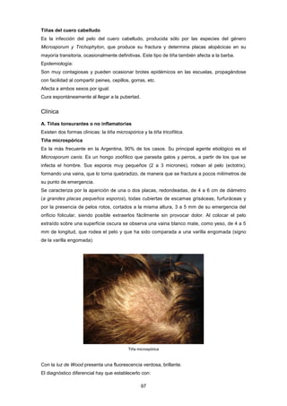 Tiñas del cuero cabelludo
Es la infección del pelo del cuero cabelludo, producida sólo por las especies del género
Microsporum y Trichophyton, que produce su fractura y determina placas alopécicas en su
mayoría transitoria, ocasionalmente definitivas. Este tipo de tiña también afecta a la barba.
Epidemiología:
Son muy contagiosas y pueden ocasionar brotes epidémicos en las escuelas, propagándose
con facilidad al compartir peines, cepillos, gorras, etc.
Afecta a ambos sexos por igual.
Cura espontáneamente al llegar a la pubertad.
Clínica
A. Tiñas tonsurantes o no inflamatorias
Existen dos formas clínicas: la tiña microspórica y la tiña tricofítica.
Tiña microspórica
Es la más frecuente en la Argentina, 90% de los casos. Su principal agente etiológico es el
Microsporum canis. Es un hongo zoofílico que parasita gatos y perros, a partir de los que se
infecta el hombre. Sus esporos muy pequeños (2 a 3 micrones), rodean al pelo (ectotrix),
formando una vaina, que lo torna quebradizo, de manera que se fractura a pocos milímetros de
su punto de emergencia.
Se caracteriza por la aparición de una o dos placas, redondeadas, de 4 a 6 cm de diámetro
(a grandes placas pequeños esporos), todas cubiertas de escamas grisáceas, furfuráceas y
por la presencia de pelos rotos, cortados a la misma altura, 3 a 5 mm de su emergencia del
orificio folicular, siendo posible extraerlos fácilmente sin provocar dolor. Al colocar el pelo
extraído sobre una superficie oscura se observa una vaina blanco mate, como yeso, de 4 a 5
mm de longitud, que rodea el pelo y que ha sido comparada a una varilla engomada (signo
de la varilla engomada).
Tiña microspórica
Con la luz de Wood presenta una fluorescencia verdosa, brillante.
El diagnóstico diferencial hay que establecerlo con:
97
 