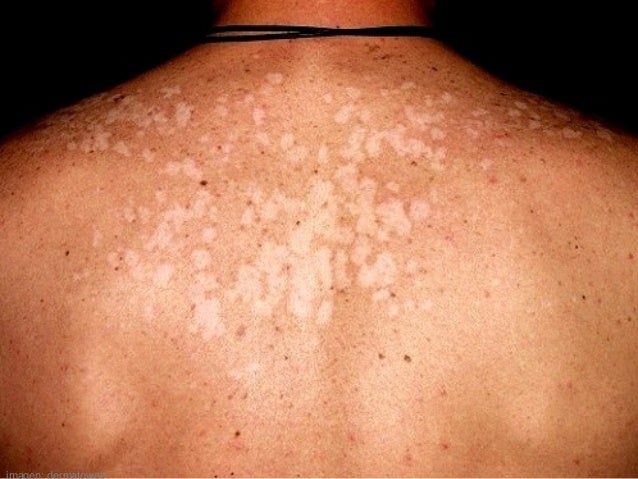 co receptivo de la piel dermatologia diagn 243 stico cl 237 nico ana 2010 publicar blog co receptivo de la piel dermatologia diagn 243 stico cl 237 nico ana 2010 publicar blog