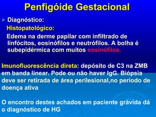Penfigóide Gestacional Diagnóstico: Histopatológico: Edema na derme papilar com infiltrado de linfócitos, eosinófilos e neutrófilos. A bolha é subepidérmica com muitos  eosinófilos. Imunofluorescência direta : depósito de C3 na ZMB em banda linear. Pode ou não haver IgG. Biópsia deve ser retirada de área perilesional,no período de doença ativa O encontro destes achados em paciente grávida dá o diagnóstico de HG 