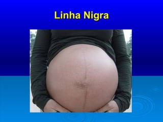 Linha Nigra 