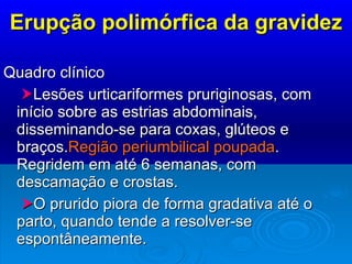 Erupção polimórfica da gravidez Quadro clínico  Lesões urticariformes pruriginosas, com início sobre as estrias abdominais, disseminando-se para coxas, glúteos e braços. Região periumbilical poupada . Regridem em até 6 semanas, com descamação e crostas.    O prurido piora de forma gradativa até o parto, quando tende a resolver-se espontâneamente. 