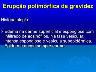 Erupção polimórfica da gravidez Histopatologia:  Edema na derme superficial e espongiose com infiltrado de eosinófilos. Na fase vesicular, intensa espongiose e vesícula subepidérmica. Epiderme quase sempre normal 