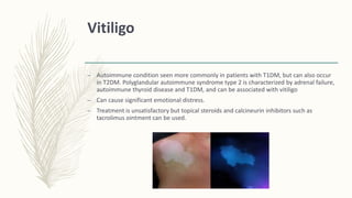 Vitiligo
– Autoimmune condition seen more commonly in patients with T1DM, but can also occur
in T2DM. Polyglandular autoimmune syndrome type 2 is characterized by adrenal failure,
autoimmune thyroid disease and T1DM, and can be associated with vitiligo
– Can cause significant emotional distress.
– Treatment is unsatisfactory but topical steroids and calcineurin inhibitors such as
tacrolimus ointment can be used.
 