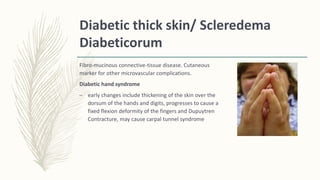 Diabetic thick skin/ Scleredema
Diabeticorum
Fibro-mucinous connective-tissue disease. Cutaneous
marker for other microvascular complications.
Diabetic hand syndrome
– early changes include thickening of the skin over the
dorsum of the hands and digits, progresses to cause a
fixed flexion deformity of the fingers and Dupuytren
Contracture, may cause carpal tunnel syndrome
 