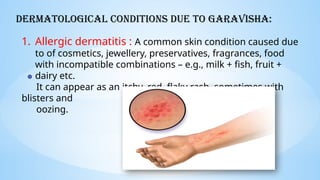 Incompatible Skin DERMATOLOGICAL CONDITION DUE TO GAR VISHA AND DUSHI VISHA (1).pptx