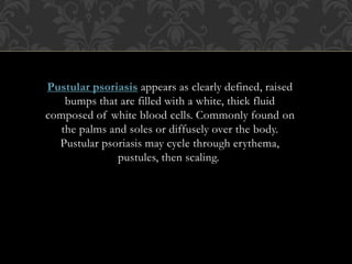 Pustular psoriasis appears as clearly defined, raised
bumps that are filled with a white, thick fluid
composed of white blood cells. Commonly found on
the palms and soles or diffusely over the body.
Pustular psoriasis may cycle through erythema,
pustules, then scaling.
 
