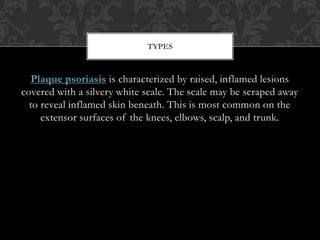 Plaque psoriasis is characterized by raised, inflamed lesions
covered with a silvery white scale. The scale may be scraped away
to reveal inflamed skin beneath. This is most common on the
extensor surfaces of the knees, elbows, scalp, and trunk.
TYPES
 
