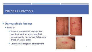 dermatological emergencies [Autosaved] [Autosaved].pptx