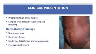 dermatological emergencies [Autosaved] [Autosaved].pptx