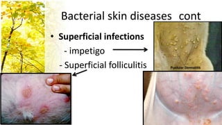 Bacterial skin diseases cont
• Superficial infections
    - impetigo
  - Superficial folliculitis
 