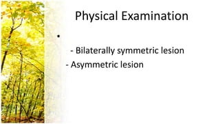 Physical Examination
•
      - Bilaterally symmetric lesion
    - Asymmetric lesion
 