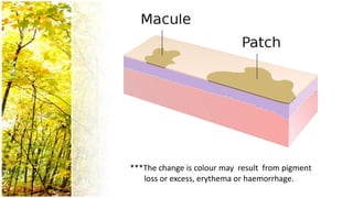 ***The change is colour may result from pigment
   loss or excess, erythema or haemorrhage.
 