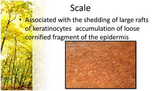 Scale
• Associated with the shedding of large rafts
  of keratinocytes accumulation of loose
  cornified fragment of the epidermis
 
