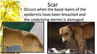 Scar
• Occurs when the basal layers of the
  epidermis have been breached and
  the underlying dermis is damaged
 