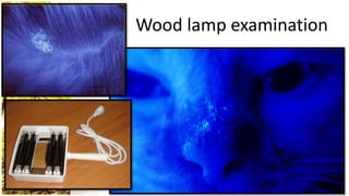 Wood lamp examination
 