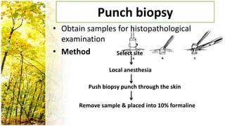 Punch biopsy
• Obtain samples for histopathological
  examination
• Method        Select site

                 Local anesthesia

          Push biopsy punch through the skin

       Remove sample & placed into 10% formaline
 