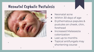 Neomatal Pustular Rash Dermatologic condition NB from NKP hospital | PDF