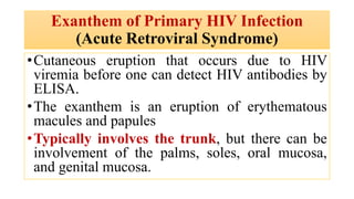 Exanthem of Primary HIV Infection
(Acute Retroviral Syndrome)
•Cutaneous eruption that occurs due to HIV
viremia before one can detect HIV antibodies by
ELISA.
•The exanthem is an eruption of erythematous
macules and papules
•Typically involves the trunk, but there can be
involvement of the palms, soles, oral mucosa,
and genital mucosa.
 