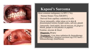 Kaposi’s Sarcoma
Most common malignancy in HIV (+Ve).
Human Herpes Virus-8(KSHV).
Derived from capillary endothelial cells
Occur intraorally, either alone or in skin &
disseminated lesions (lymph nodes, salivary gland)
Intraorally- hard palate, buccal mucosa, & gingiva -
bluish, purple or red patches or papules
Nodular, ulcerate & bleed
Diagnosis: Biopsy
Treatment: -Low dose radiation & chemotherapy
(eg.Vinblastine) -Surgical excision (eg.CO2 laser) -
Immunotherapy (Interferon).
 