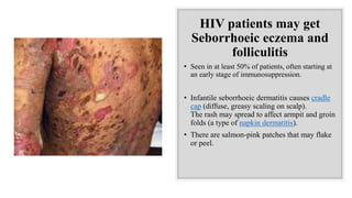HIV patients may get
Seborrhoeic eczema and
folliculitis
• Seen in at least 50% of patients, often starting at
an early stage of immunosuppression.
• Infantile seborrhoeic dermatitis causes cradle
cap (diffuse, greasy scaling on scalp).
The rash may spread to affect armpit and groin
folds (a type of napkin dermatitis).
• There are salmon-pink patches that may flake
or peel.
 