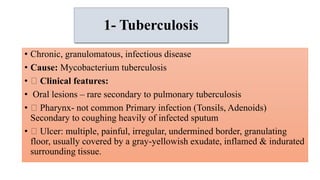 1- Tuberculosis
• Chronic, granulomatous, infectious disease
• Cause: Mycobacterium tuberculosis
• Clinical features:
• Oral lesions – rare secondary to pulmonary tuberculosis
• Pharynx- not common Primary infection (Tonsils, Adenoids)
Secondary to coughing heavily of infected sputum
• Ulcer: multiple, painful, irregular, undermined border, granulating
floor, usually covered by a gray-yellowish exudate, inflamed & indurated
surrounding tissue.
 