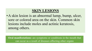 SKIN LESIONS
•A skin lesion is an abnormal lump, bump, ulcer,
sore or colored area on the skin. Common skin
lesions include moles and actinic keratosis,
among others.
Oral manifestations: are symptoms or conditions in the mouth that
can occur as a result of diseases affecting other organs
 