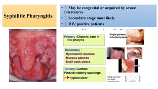 Syphilitic Pharyngitis
• May be congenital or acquired by sexual
intercourse
• Secondary stage most likely
• HIV positive patients
 