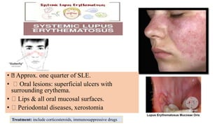 Treatment: include corticosteroids, immunosuppressive drugs
• Approx. one quarter of SLE.
• Oral lesions: superficial ulcers with
surrounding erythema.
• Lips & all oral mucosal surfaces.
• Periodontal diseases, xerostomia
 