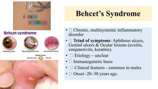 Behcet’s Syndrome
• Chronic, multisystemic inflammatory
disorder
• Triad of symptoms: Aphthous ulcers,
Genital ulcers & Ocular lesions (uveitis,
conjunctivits, keratitis).
• Etiology – unclear
• Immunogenetic basis
• Clinical features - common in males
• Onset -20–30 years age.
 