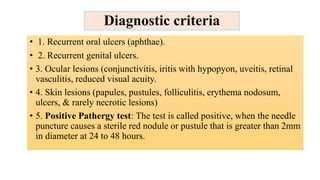 Diagnostic criteria
• 1. Recurrent oral ulcers (aphthae).
• 2. Recurrent genital ulcers.
• 3. Ocular lesions (conjunctivitis, iritis with hypopyon, uveitis, retinal
vasculitis, reduced visual acuity.
• 4. Skin lesions (papules, pustules, folliculitis, erythema nodosum,
ulcers, & rarely necrotic lesions)
• 5. Positive Pathergy test: The test is called positive, when the needle
puncture causes a sterile red nodule or pustule that is greater than 2mm
in diameter at 24 to 48 hours.
 