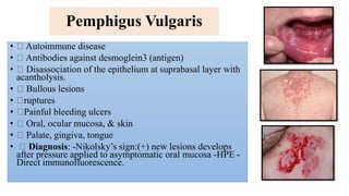 Pemphigus Vulgaris
• Autoimmune disease
• Antibodies against desmoglein3 (antigen)
• Disassociation of the epithelium at suprabasal layer with
acantholysis.
• Bullous lesions
• ruptures
• Painful bleeding ulcers
• Oral, ocular mucosa, & skin
• Palate, gingiva, tongue
• Diagnosis: -Nikolsky’s sign:(+) new lesions develops
after pressure applied to asymptomatic oral mucosa -HPE -
Direct immunofluorescence.
 