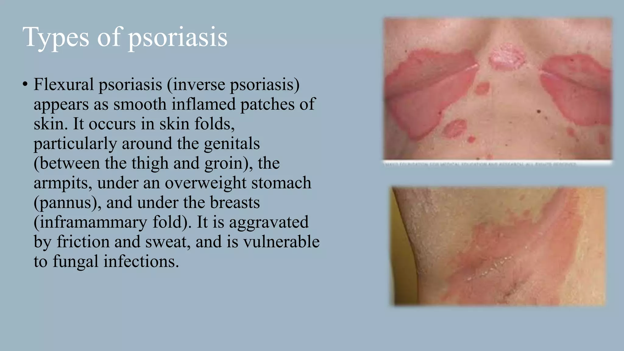 dermatology-psoriasis-pptx-skin-and-dermatology-diseases-and