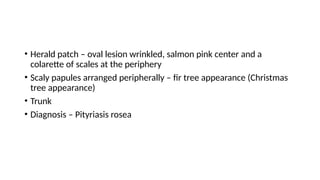 • Herald patch – oval lesion wrinkled, salmon pink center and a
colarette of scales at the periphery
• Scaly papules arranged peripherally – fir tree appearance (Christmas
tree appearance)
• Trunk
• Diagnosis – Pityriasis rosea
 