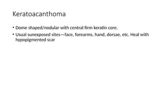 Keratoacanthoma
• Dome shaped/nodular with central firm keratin core.
• Usual sunexposed sites—face, forearms, hand, dorsae, etc. Heal with
hypopigmented scar
 