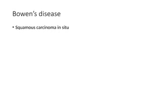 Bowen’s disease
• Squamous carcinoma in situ
 